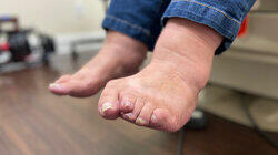 Moms Got Athletes Foot! Moms Got Athletes Foot!
