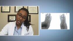 Achy Break-Y Feet Achy Break-Y Feet