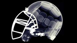 League of Denial: The NFL's Concussion Crisis League of Denial: The NFL's Concussion Crisis