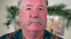 Every Rosacea Has Its Thorn Every Rosacea Has Its Thorn