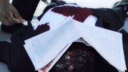 Bleed All About It Bleed All About It