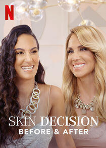 Skin Decision: Before and After Skin Decision: Before and After