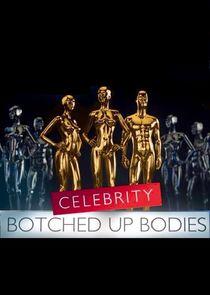 Celebrity Botched Up Bodies Celebrity Botched Up Bodies
