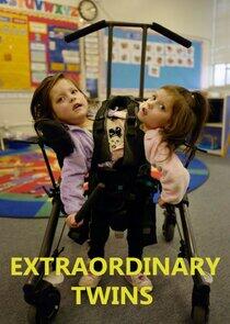 Extraordinary Twins Extraordinary Twins