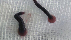 Mystery of the Face Parasite