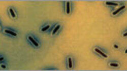 Bioterror Bioterror