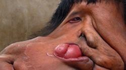I Am the Elephant Man I Am the Elephant Man