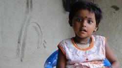 Girl with Eight Limbs Grows Up Girl with Eight Limbs Grows Up