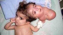 Born with Two Heads Born with Two Heads